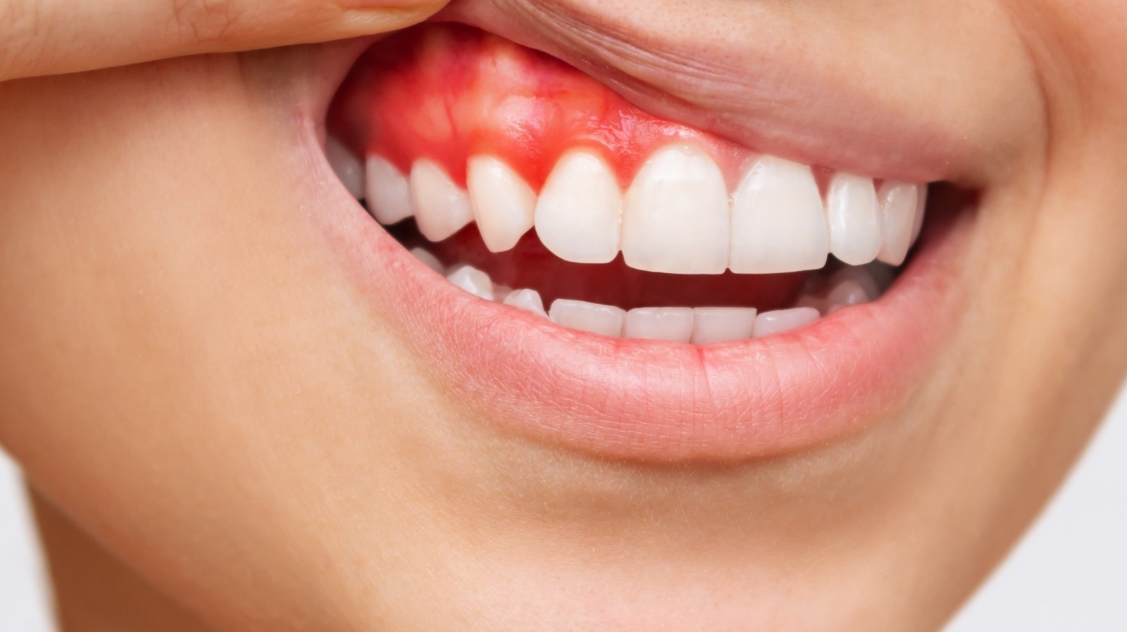 Everything You Need To Know About Your Gums