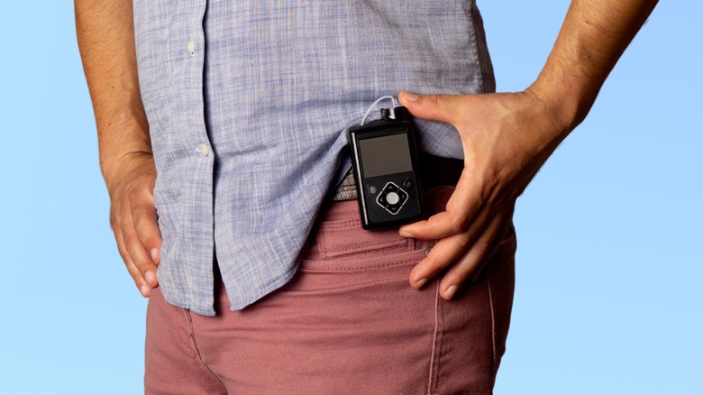 Young man with insulin pump