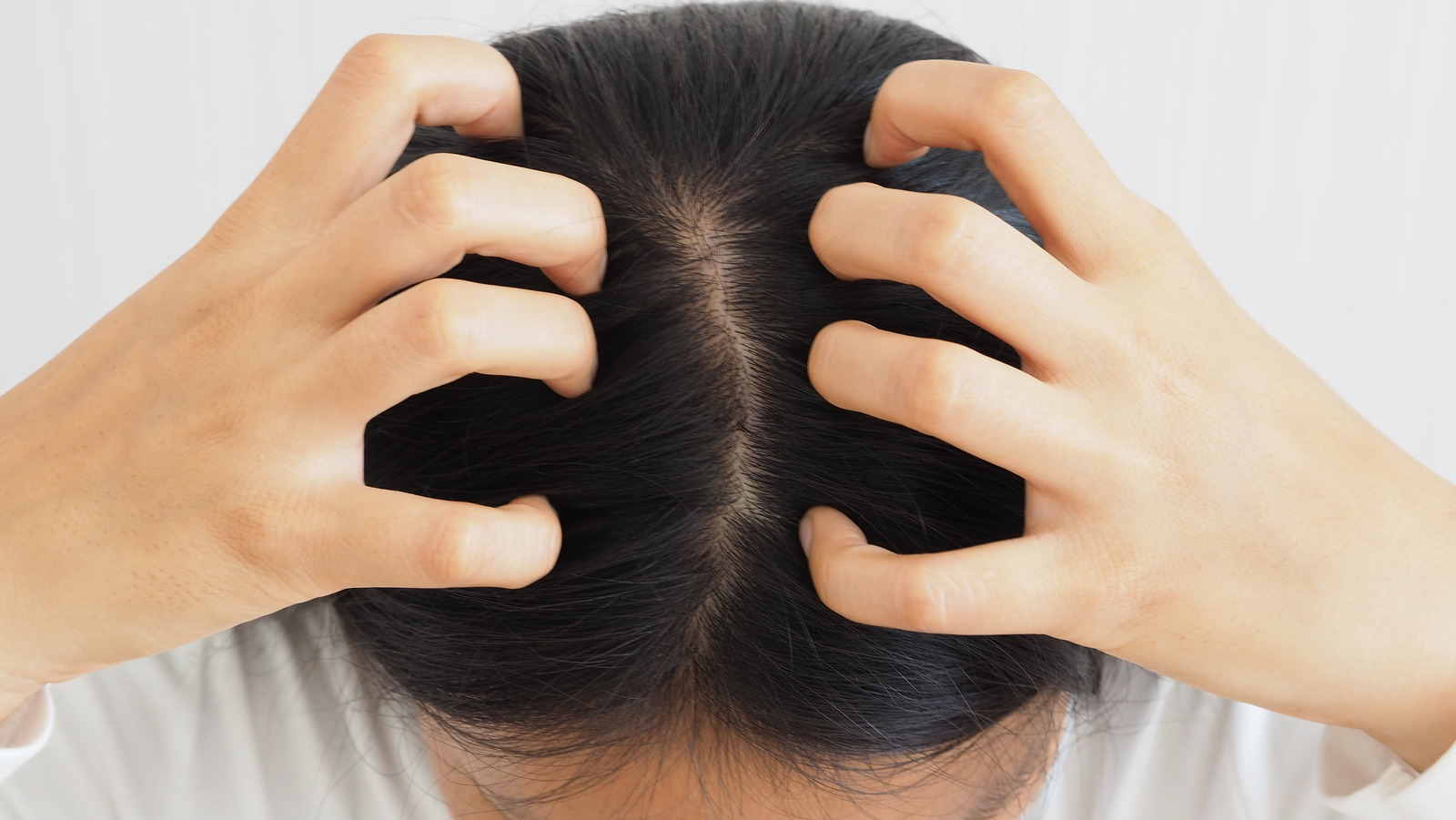 Everything You Should Know About Head Lice Everything You Should Know About Head Lice