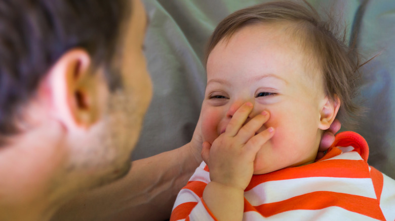 Dad cuddling baby with Down syndrome