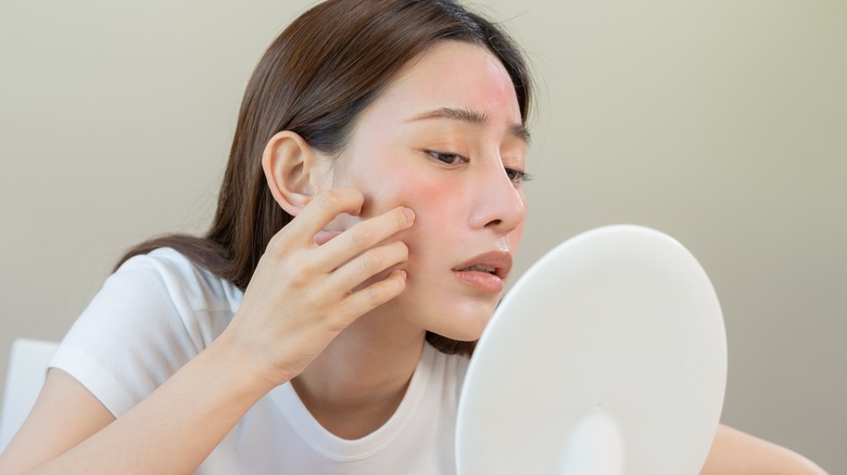 girl with swollen face