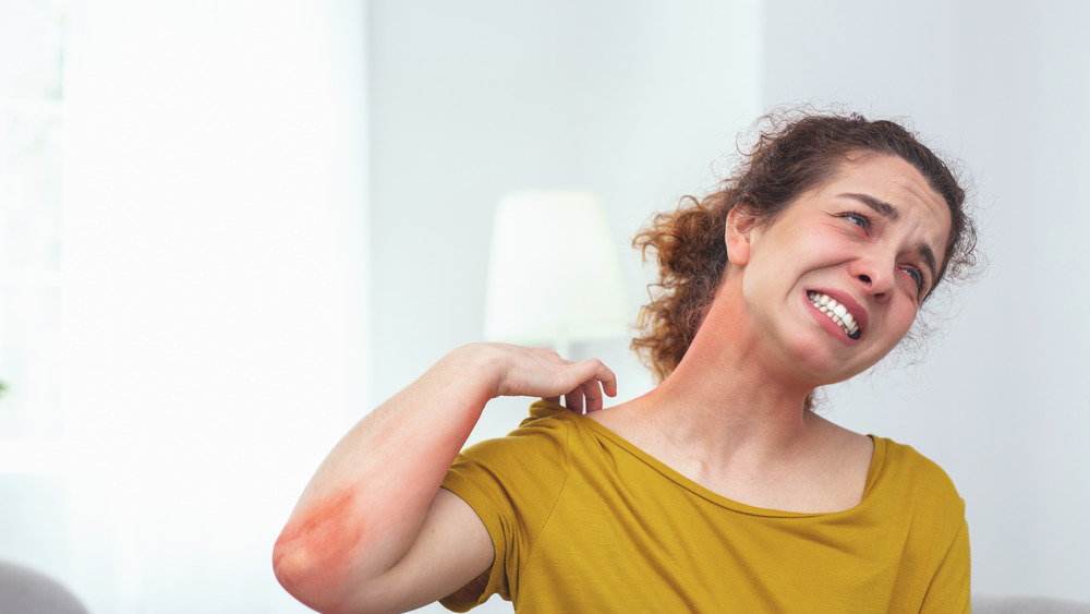 Woman scratching her shoulder