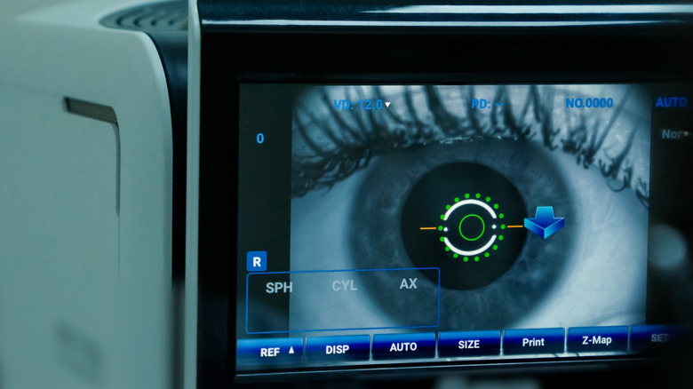 eye close-up on screen at ophthalmologist appointment