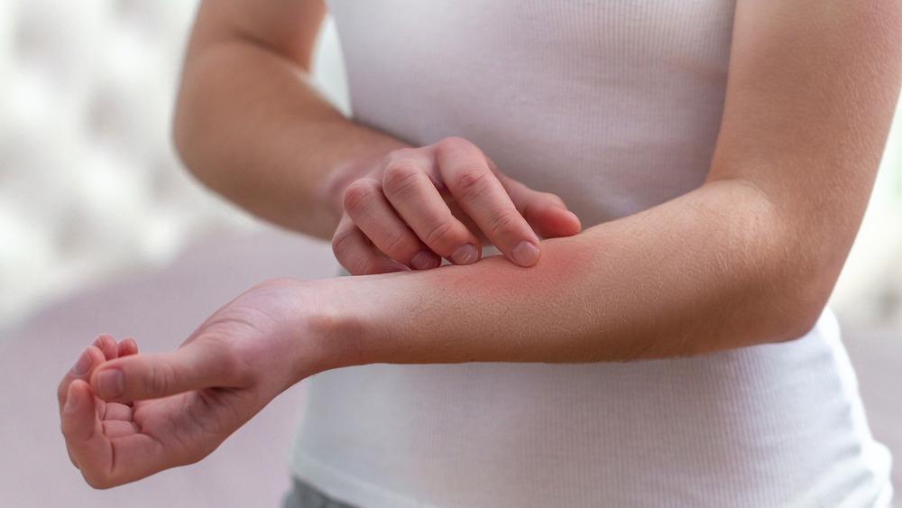 woman scratching arm