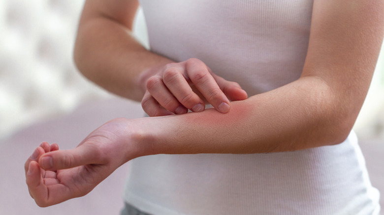 woman scratching arm