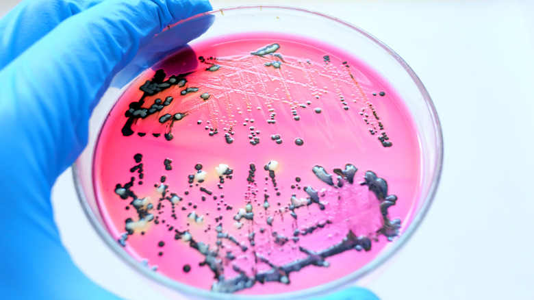 Salmonella in a petri dish