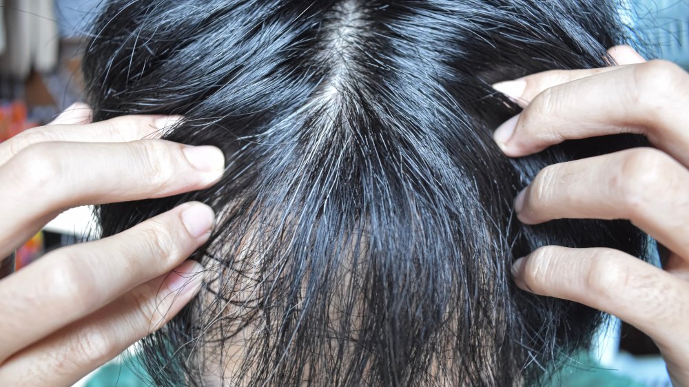 Prematurely gray hair