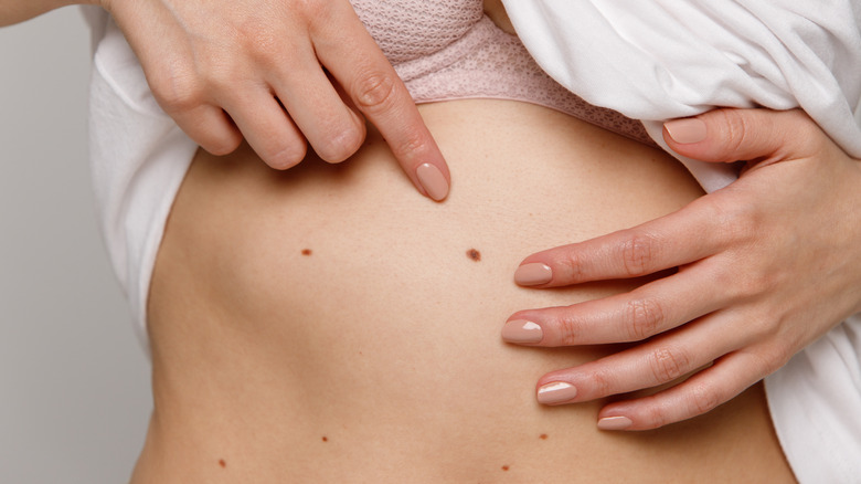 woman pointing to a recently discovered mole on her stomach 