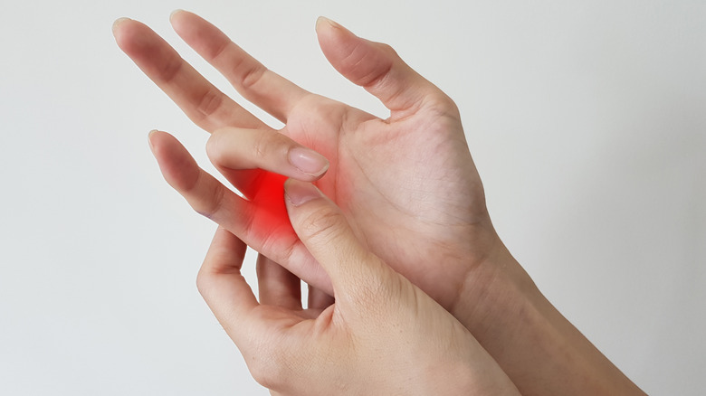 A pair of hands with ring finger red and inflamed with a case of trigger finger