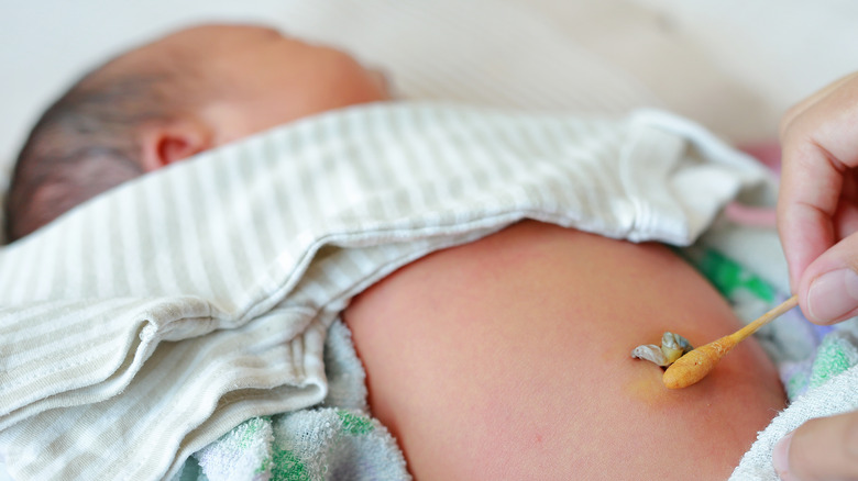 Baby receiving umbilical cord cleaning