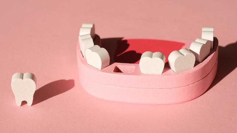 model of mouth missing tooth