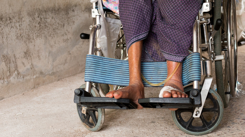 woman in wheel chair with catheter bag