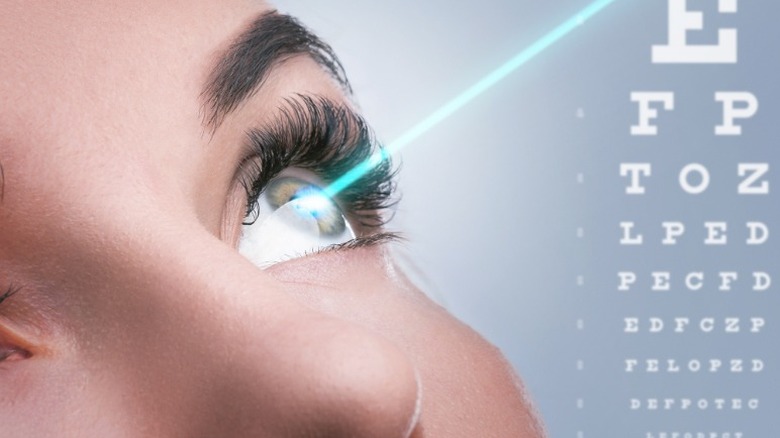LASIK eye surgery 