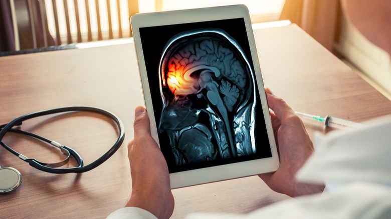 Doctor holding iPad brain image