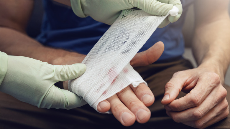 Doctor wrapping patient hands in gauze