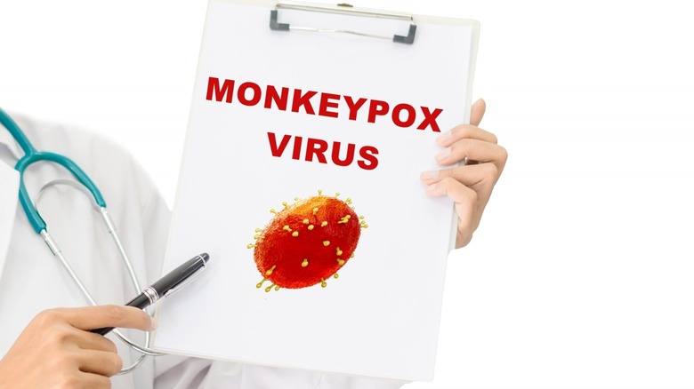 Doctor with clipboard reading 'monkeypox virus'