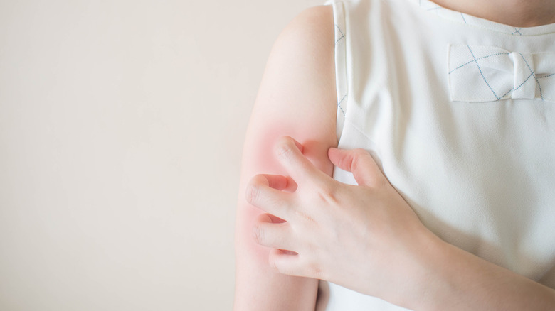 Person scratching their dry, red skin on their arm