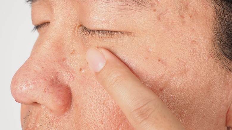 A man pointing to his eyelid