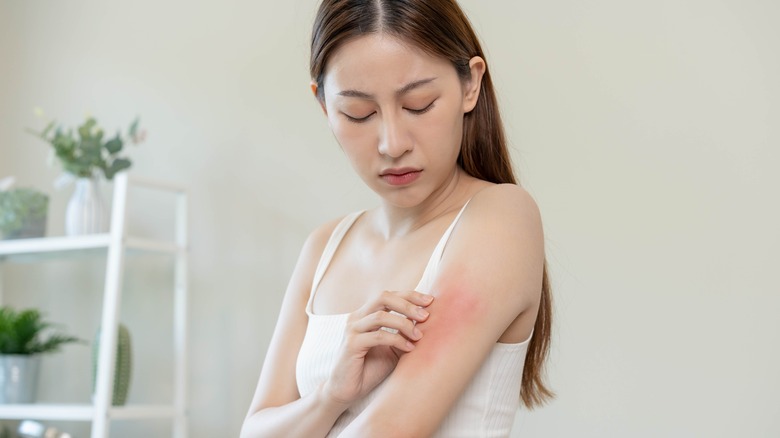 woman scratching inflamed skin
