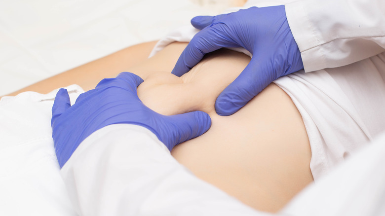 doctor checking belly for hernia