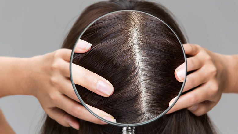 woman going bald