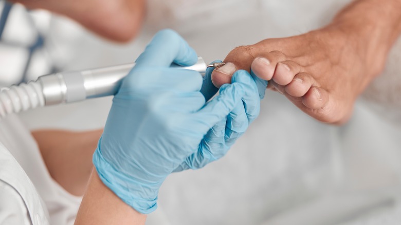 Podiatrist performing toenail procedure