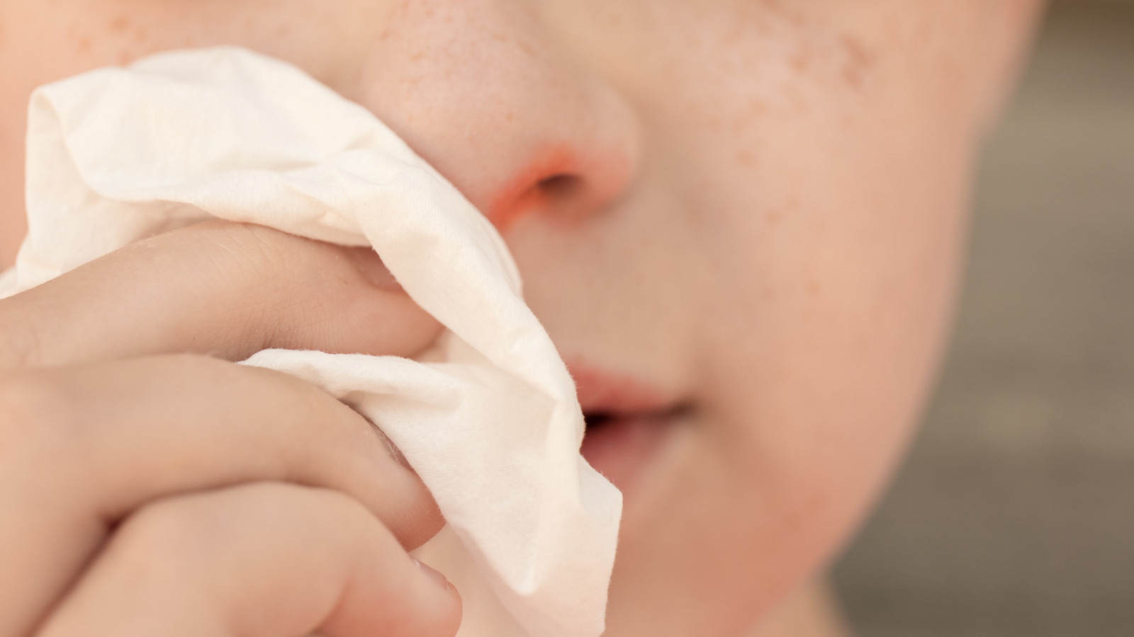 How To Treat An Dry, Cracked Nose