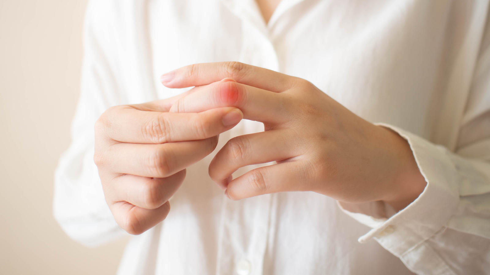 How To Treat Burned Fingers