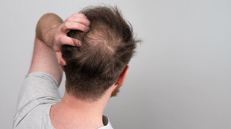 Behind view of balding man