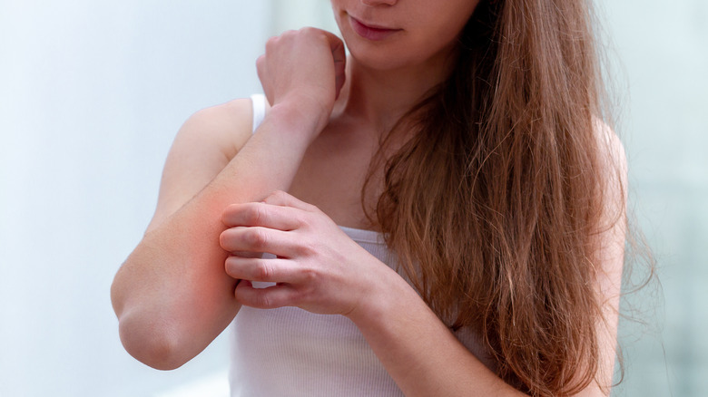 Woman itching her skin