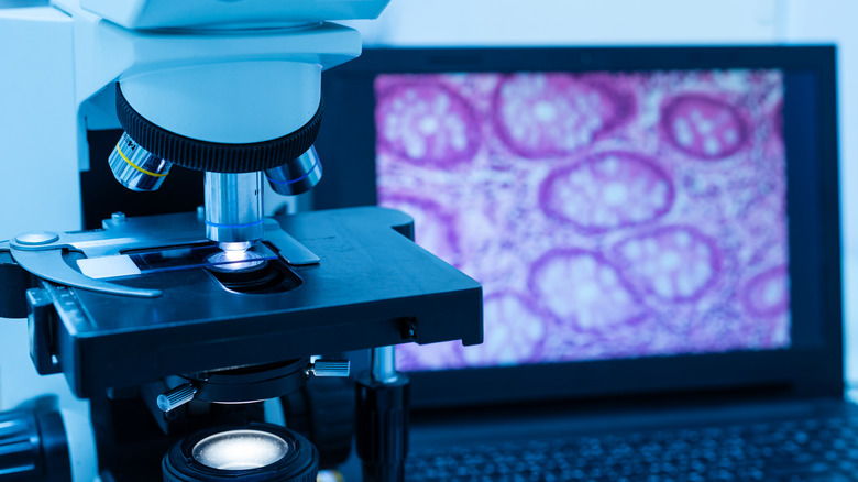 Microscope and computer screen displaying cell images