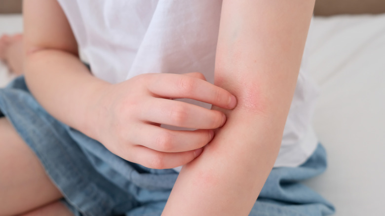 Person scratching arm