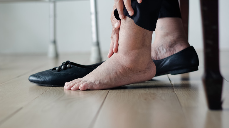 woman's swollen foot by shoe