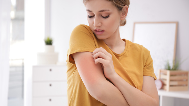 A woman scratches her arm