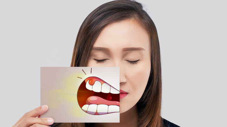 asian woman holding a card to display swollen gums