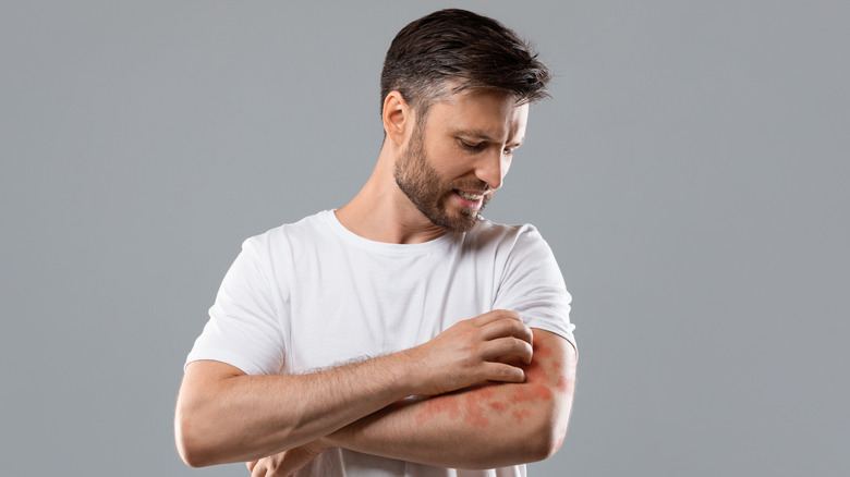 man scratching arm