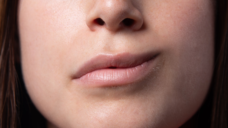 close image of woman with Bell's palsy condition