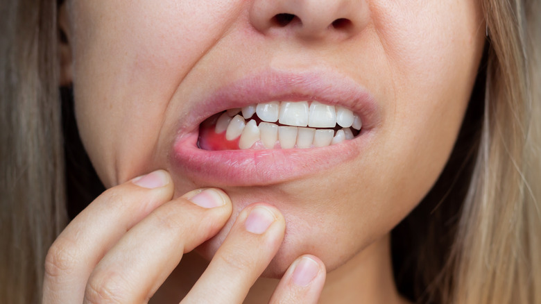 woman showing bleeding gums