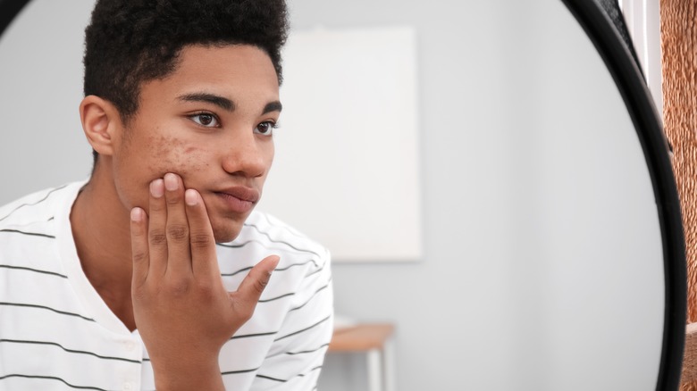 A boy looks at his acne in the mirror