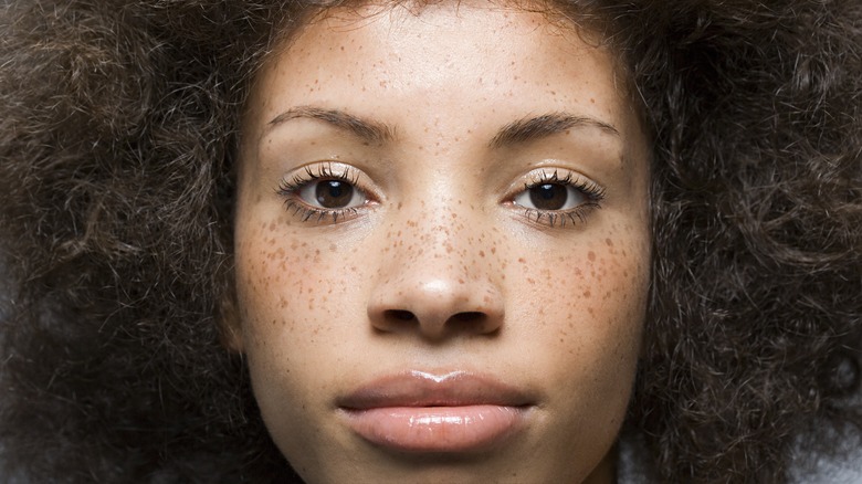 woman with freckles on face