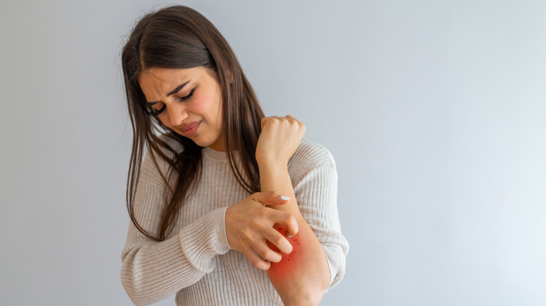 Woman scratching her arm