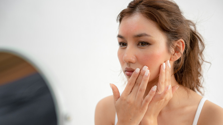 Woman touching cheek rash