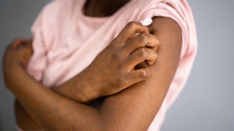 woman itching her arm