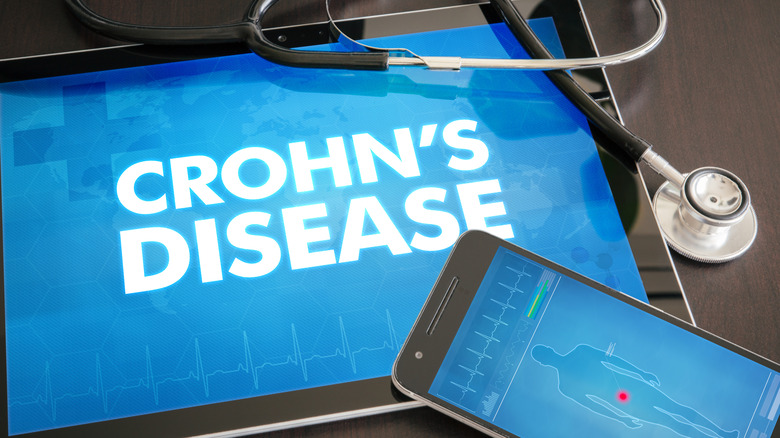 crohn's disease on tablet