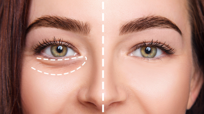 woman with cosmetic markings on face