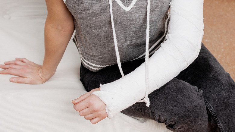 Close up of woman's arm in a cast