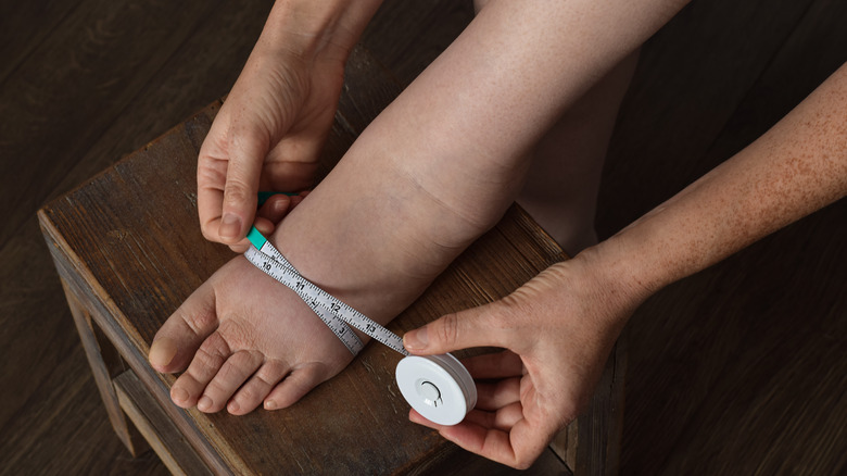 woman with lymphedema measuring her foot size