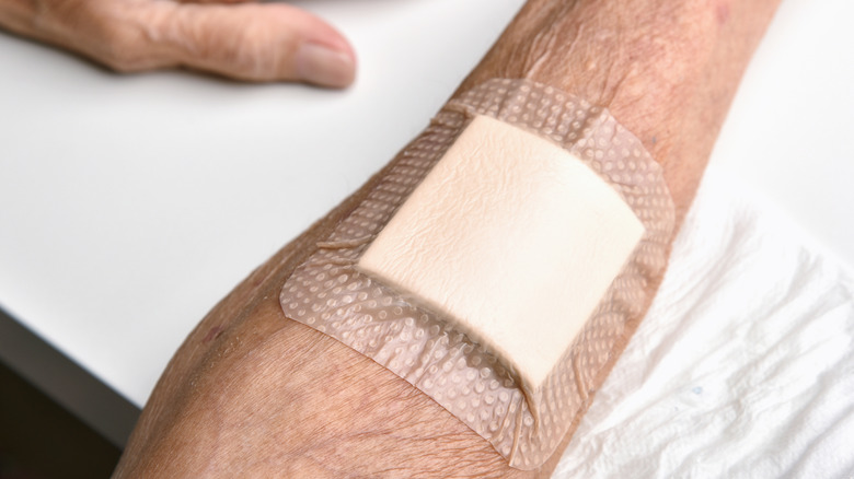 Wound bandage covering an arm with thin skin