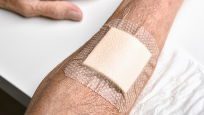 Wound bandage covering an arm with thin skin