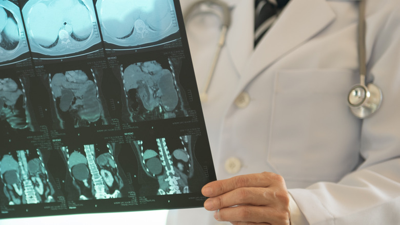 doctor looking at xrays to diagnose patient